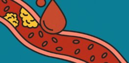 Is high cholesterol a red alarm? It’s time to reassess the meaning of blood lipid levels