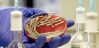 Threat from drug resistant ‘superbugs’ is growing