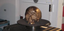 Bioinformatics bonanza: The curious case of shrunken 2600-year old brain