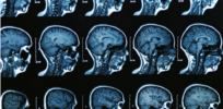 When does brain function peak? Scans show how brains grow and shrink