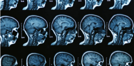 When does brain function peak? Scans show how brains grow and shrink