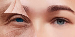 Can we ‘reverse’ aging? ‘Reprogrammed’ skin cells offer promise — but we don’t know why