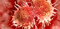 Can we ‘cure’ cancer by reprogramming our cells?