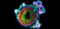Viewpoint: Miniaturized organs made from stem cells — What are the ethical considerations?