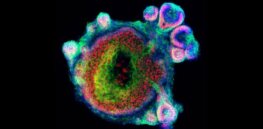 Viewpoint: Miniaturized organs made from stem cells — What are the ethical considerations?