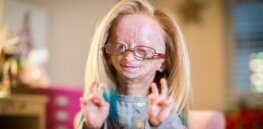 CRISPR gene editing poised to ‘cure’ progeria and other diseases caused by ‘misspelled’ DNA