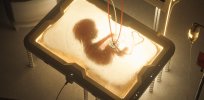 When does an embryo become viable? Artificial uterus in development may dramatically lower the number of weeks