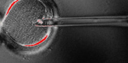 4,000 US children are born each year with mitochondrial disease. Why are there still blocks on replacement therapy?