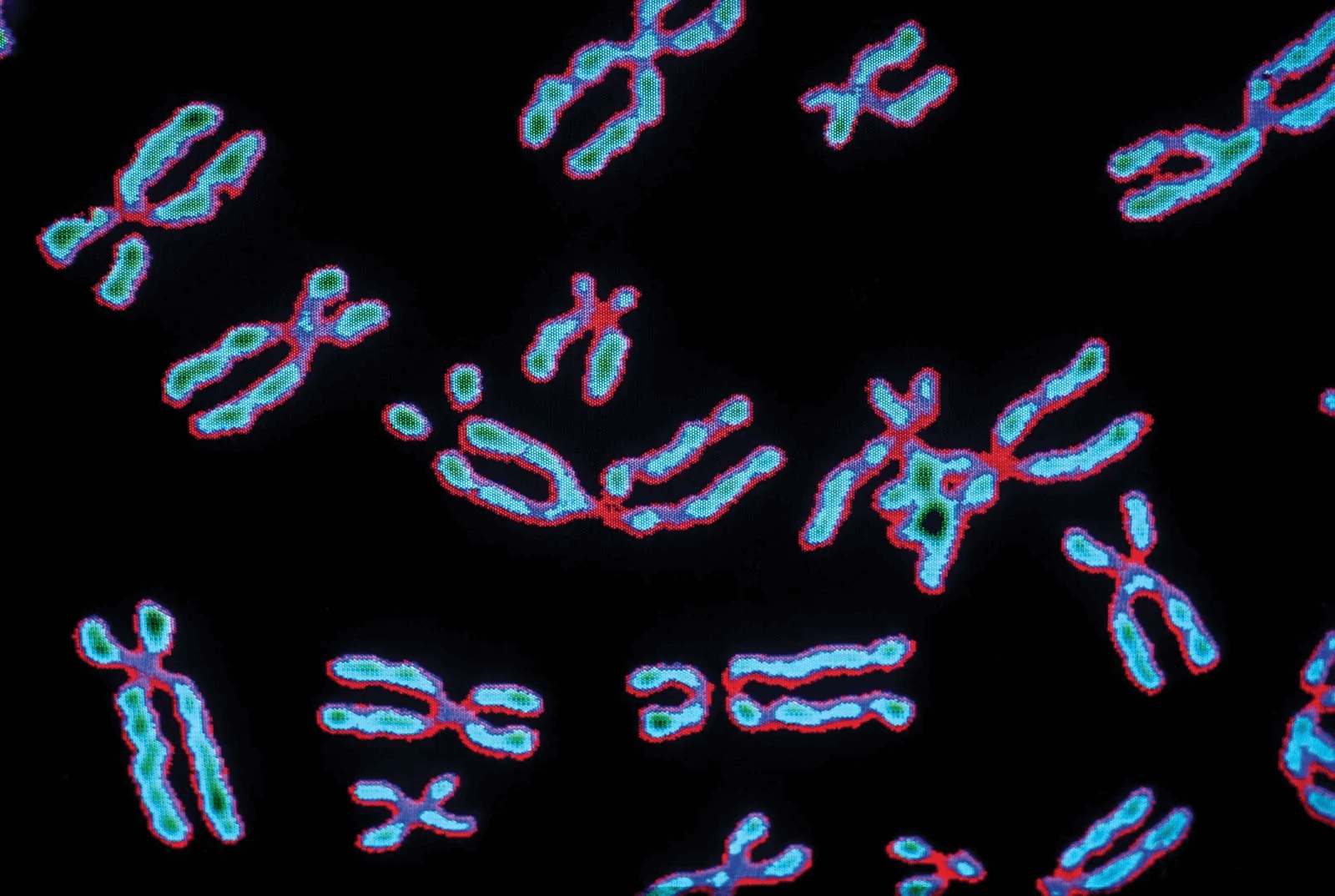 Хромосомы лучше видны. Хромосомные болезни хромосомы. Хромосомные аберрации. Клетка ДНК человека 46 хромосом. Хромосомные мутации под микроскопом.