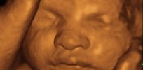 How fetal facial scans can help identify serious diseases early