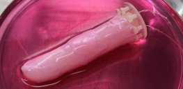 Robotic realism: For the first time, human skin engineered to grow on a robot’s finger