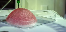 3-D printed breast implants? This alternative to silicon regrows breast tissue and degrades without a trace