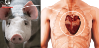 Facing human donor organ shortage, US poised to allow pig organ transplant trials