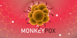 Why the US is ill prepared if monkeypox escalates into a pandemic