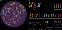 ‘70% of human eggs have the wrong number of chromosomes’: Here’s why so many people struggle with fertility