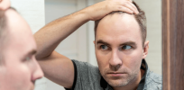 Strange symptoms: Hair and libido loss linked to long COVID
