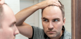 Strange symptoms: Hair and libido loss linked to long COVID