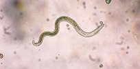 Worm world: Are there more parasites now than ever?
