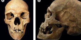 Ancient DNA: Here’s how a thousand-year-old skeleton was diagnosed with a genetic disorder
