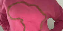 Treatment-resistant triple-negative breast cancer disproportionately affects Black women. African genetic ancestry may explain why