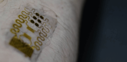 smart bandages that can monitor wounds as they heal