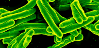 Clues to possible new treatments for tuberculosis: Genetic mutation that leads to Gaucher disease may protect Ashkenazi Jews from TB