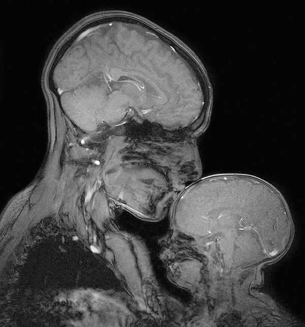 An MRI scan shows MIT neuroscientist Rebecca Saxe kissing her 2-month-old son. Advances in imaging software have allowed researchers to better study the changing brains of babies.