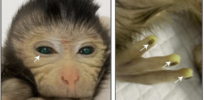 The green fluorescent signals in the eyes and fingers of the live-birth chimeric monkey at three days of age. (Cao et al., Cell, 2023)