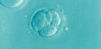 UK scientists support loosening restrictions limiting embryo research