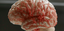 3D-printed brains: Brain tissue breakthrough ‘could change the way we look at neurological and psychiatric disorders’