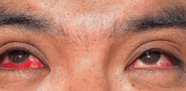 ‘Heightened alert’: Avian flu detected in water supplies, virus found in the meat of one cow, and flu-tainted milk has infected mice and cats