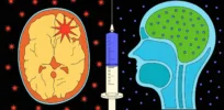 brain tumor vaccine cs