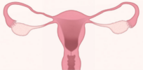 Removing both ovaries can have overlooked brain health consequences in the long run