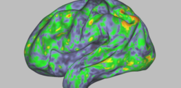 This is your brain on ‘magic mushrooms’