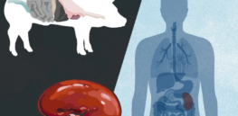 State-of-the-art pig farm aims to pump out 125 pig organs for human transplant a year