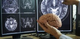 Free will and the brain: Challenges to long-standing belief that that addiction is a disease