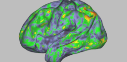 A scientist's brainy trip: How psilocybin creates an extraordinary new sense of space, time and self