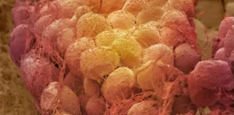 Memory of obesity: Fat cells are at war with your diet