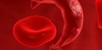 Casgevy costs $2.2 million: First patient outside of a trial receives CRISPR cancer treatment