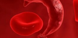 Casgevy costs $2.2 million: First patient outside of a trial receives CRISPR cancer treatment