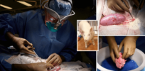 Genetically modified pig organ transplants may soon save thousands every year