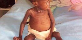 Food insecurity crisis intensifies: Almost 300 million people globally face hunger and malnutrition.
