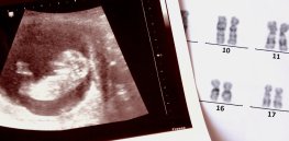 Treating genetic disorders before birth: Prenatal and newborn genetic screening is surging