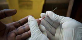 4 million deaths, 10 million cases anticipated: Trump administration has dismantled decades of progress in reducing AIDS infections and deaths