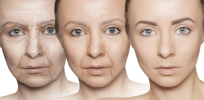 Longevity medicine: Exploitation or an innovative approach to health?