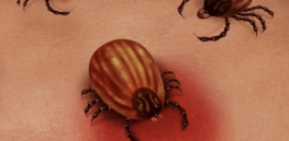 Viewpoint: Hollywood’s latest bizarre (un)health fetish: ‘I have Lyme disease!!’