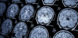 CRISPR brain ‘gene editing’ could open the door to cure neurological diseases