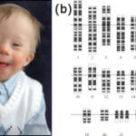 downsyndrome_compilation_MID_1