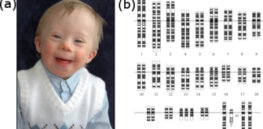 CRISPR breakthrough that can remove the chromosome responsible for Down syndrome raises ethical questions