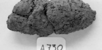 Preserved poop offers a window into the health and life of ancient humans